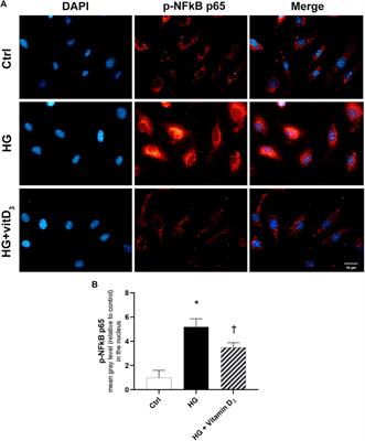 Vitamin D3 preserves blood retinal barrier integrity in an in vitro model of diabetic retinopathy
